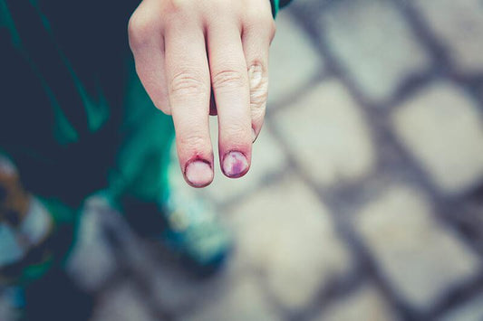 Ruhjeita keskisormessa ja nimettömässä